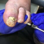 Caring Steps: A Gentle Guide for Everyday Foot Wellness