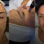 A Dubai Tale of Confidence Restored by Skin Camouflage