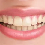 Dental digital X-rays Charlotte | Precise, comfy scans at Blakeney Smile Dentistry