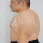 Mounjaro Injection Price Malaysia – What to Expect