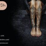Advanced skin renewal through Picoway tattoo removal services