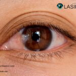 Pterygium Remedy | Pterygiumhouston.com