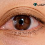 Eye Surgery: Pterygium Removal in Houston by Trusted Specialists