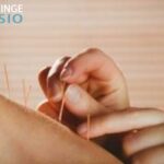 Akupunktur i Haninge – lindra smärta hos Haningefysio