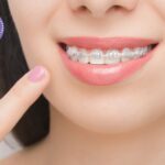 Estètica Dental Gines: somriure perfecte i confiança