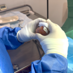 Fungal Nails Surgery: Safe, Local Anaesthetic Treatment in the UK